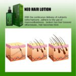 Neo Hair Lotion 120ml Hair loss Treatment & Regrowth - Image 3