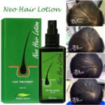 Neo Hair Lotion 120ml Hair loss Treatment & Regrowth - Image 5