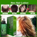 Green Wealth Neo Hair Lotion 120ml Original Hair loss Treatment & Regrowth - Image 5