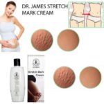 Dr. James Stretch Mark Cream - Image 2