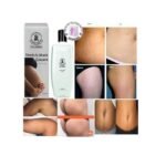 Dr. James Stretch Mark Cream - Image 4