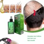 Original Neo hair Lotion Full Package ( 3+3 ) Hair Loss & Regrowth - Image 4