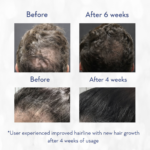 Qawora Revive Hair Oil- Regrowth, Shine, Thick, Hair Fall Solution - Image 4