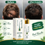 Qawora Revive Hair Oil – Advance Herbal Growth Formula - 100 ml - Image 4
