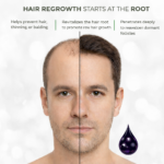 Qawora Revive Hair Oil- Regrowth, Shine, Thick, Hair Fall Solution - Image 2